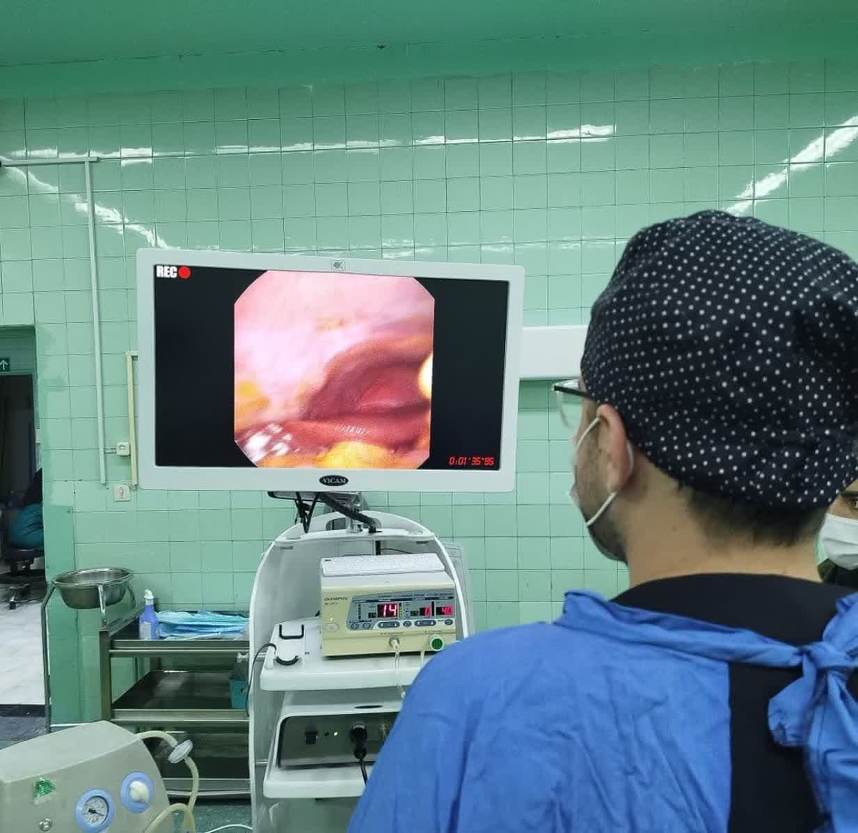 ����رئیس بیمارستان ولیعصر (عج) رزن از انجام موفقیت آمیز اولین عمل جراحی کله سیستکتومی به روش لاپاراسکوپی در این بیمارستان  خبر داد.